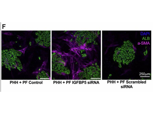 Immunohistochemistry using Human Albumin